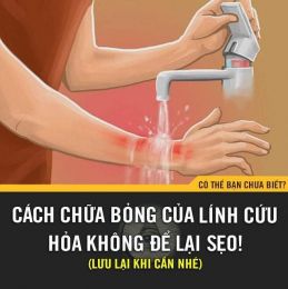 Cách chữa bỏng của lính cứu hỏa không để lại sẹo